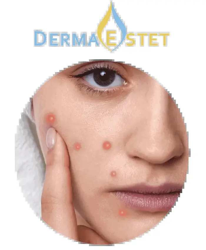 Derma Estet — reklamní grafika
